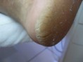 /album/fotos/fissura-jpg/